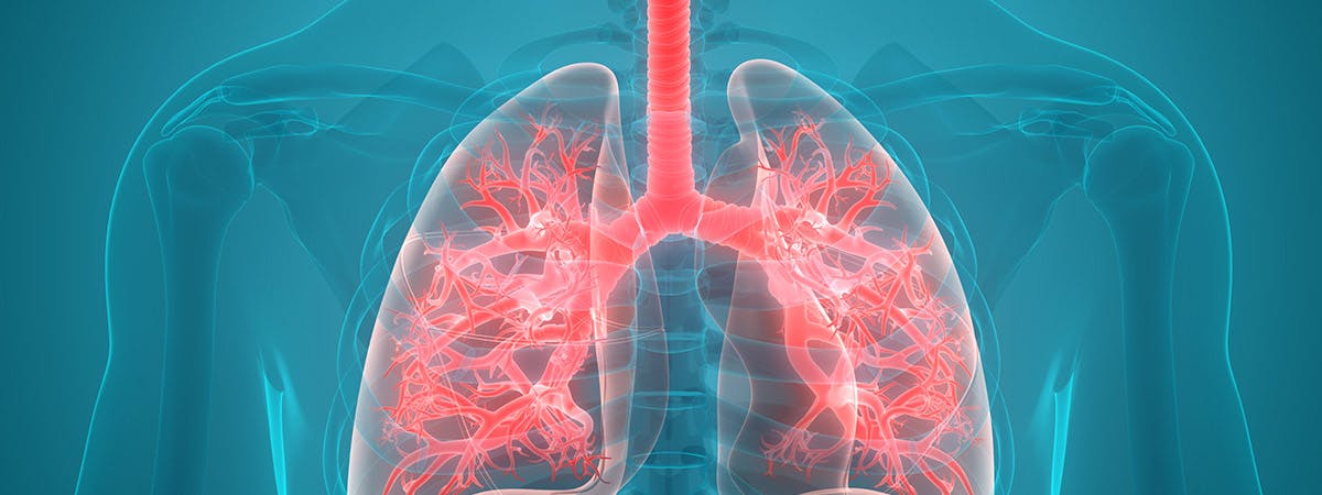 Epigenetic modifications of COPD, a lung disease that involves shortness of breath.