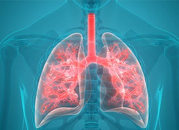 Epigenetic modifications of COPD, a chronic lung condition that causes shortness of breath.